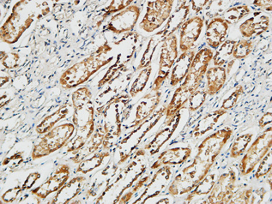 IHC - p38 Polyclonal Antibody AP71696